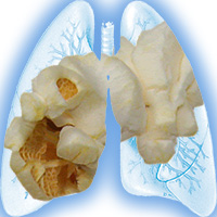 用于制造黄油味的双乙酰产生的烟雾可能对你的肺有害。