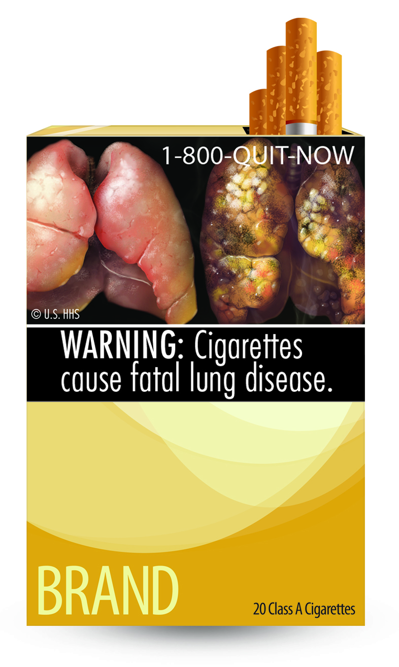 慢性阻塞性肺疾病(COPD)的35个事实