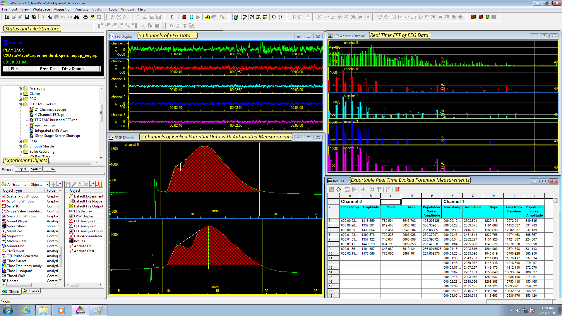SCIWork的EEG记录和分析